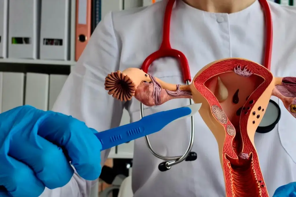 Essential What Deficiency Causes Fibroids (Fibroids Deficiency)?