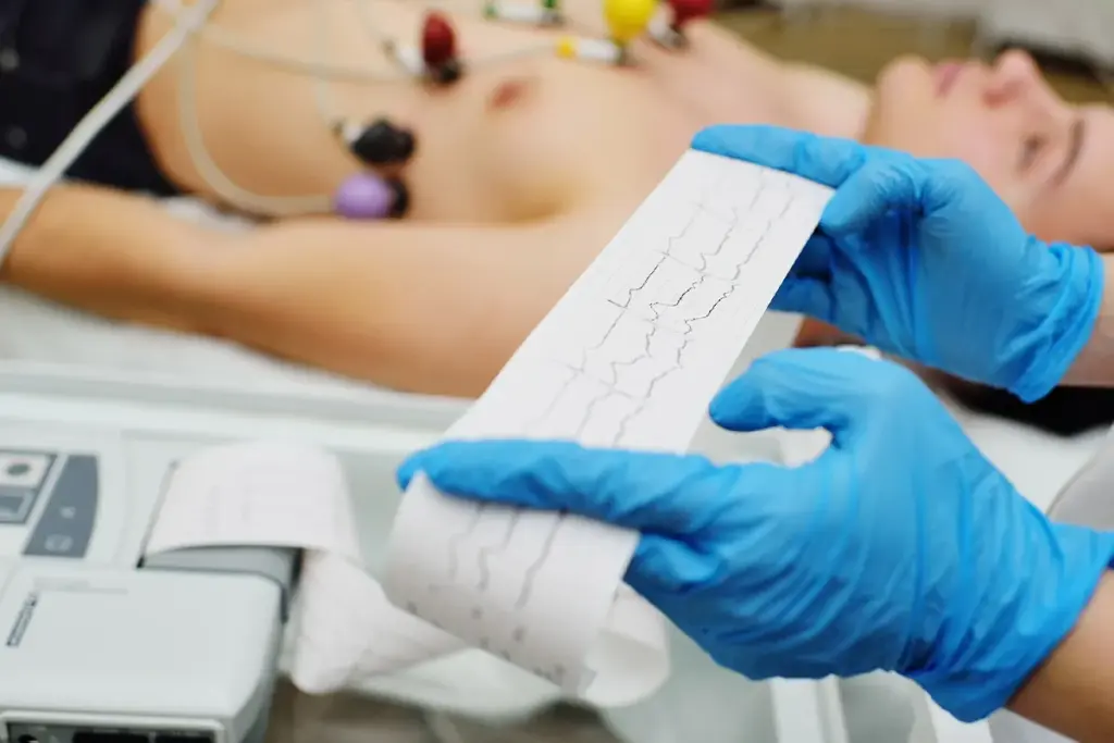 EKG: Best Safety & Side Effects Guide 3 EKG: Best Safety & Side Effects Guide