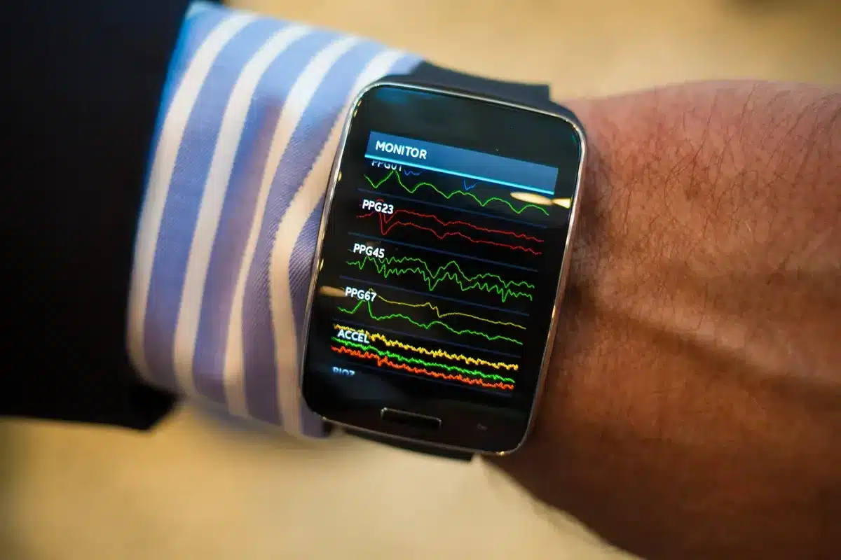 ECG Apple Watch: Best Accuracy Insights